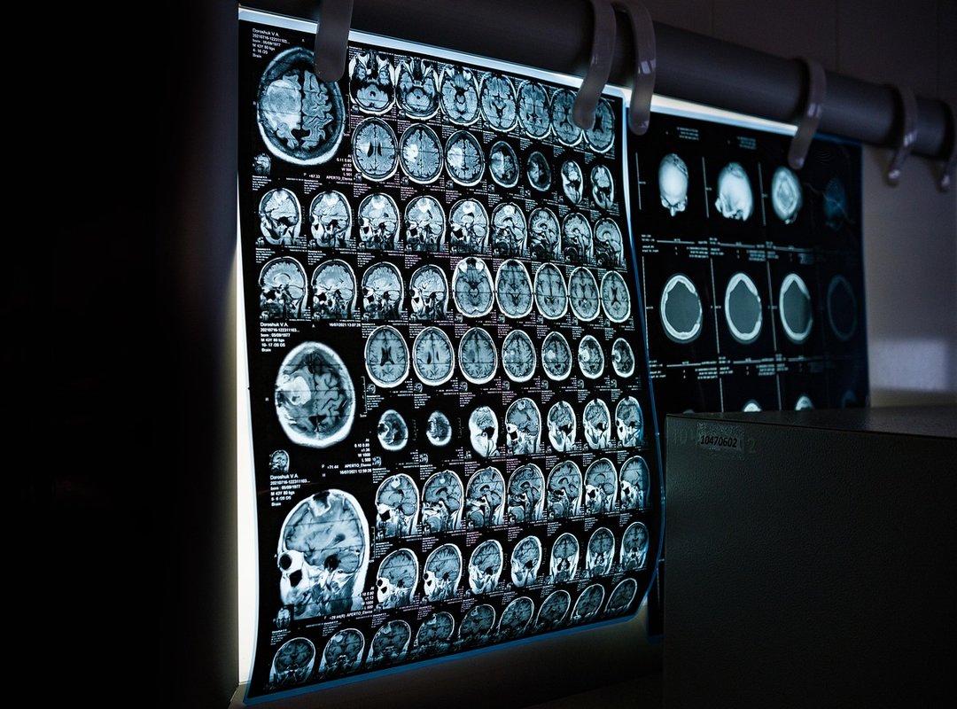 How to Safely Access and Use the Asura Scans Website